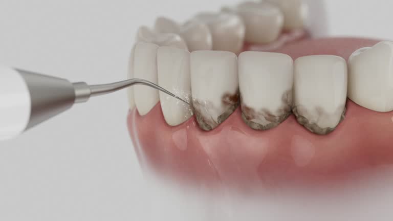 Reliable Dental contractor in Gleneagle, CO by Smile Center Dentistry